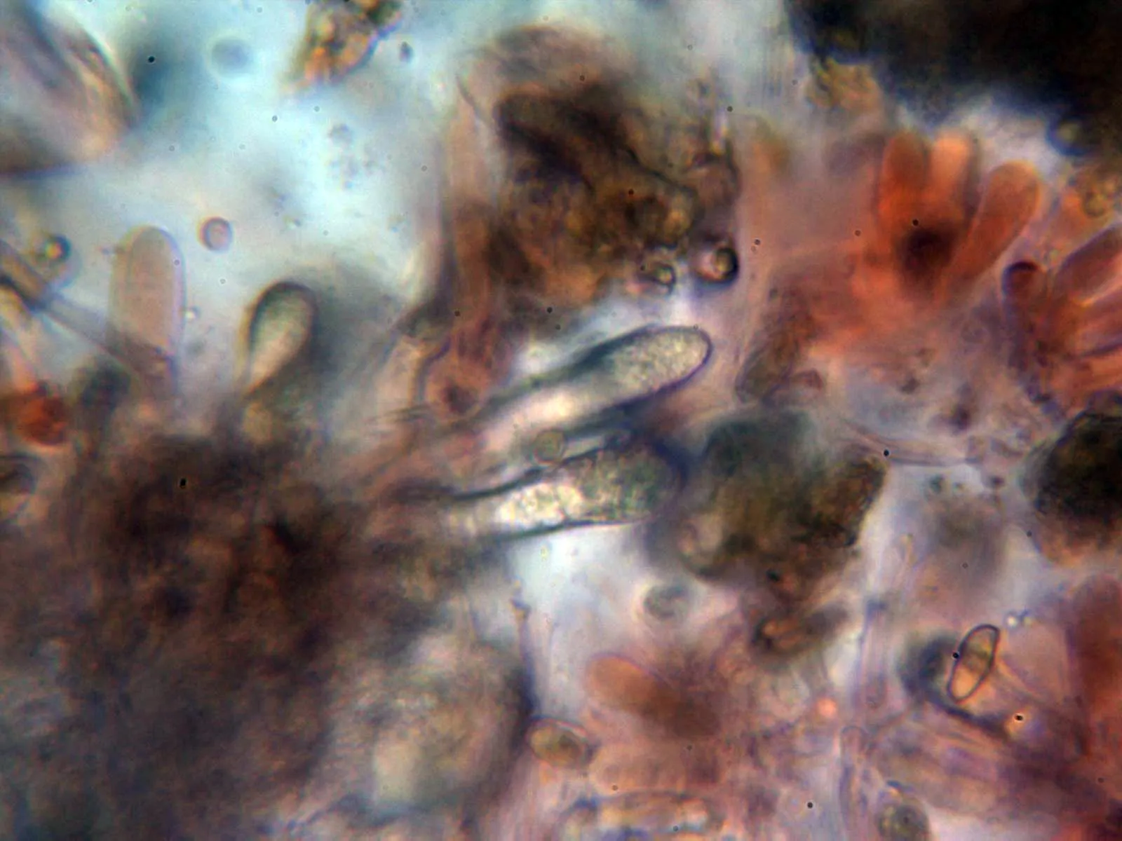 Microscopía de Suillus granulatus - 12 - Queilocistidios